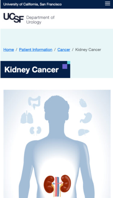 Mobile version of the UCSF Urology kidney cancer page